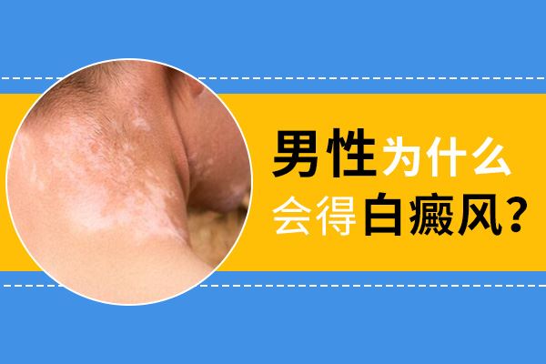 白癜风白斑跟正常皮肤一样